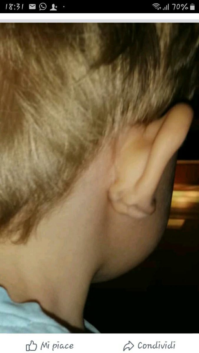 . Bambini rubati. Bruno, 2 anni e mezzo e un orecchio rotto, in comunità - 15/09/2019